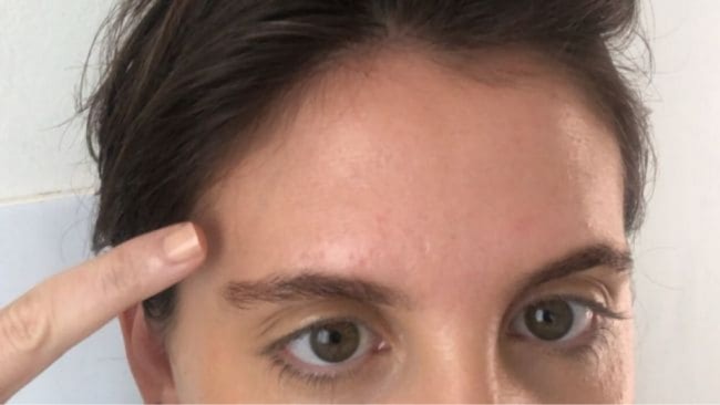 Wrinkles Schminkles Forehead Smoothing Kit: review