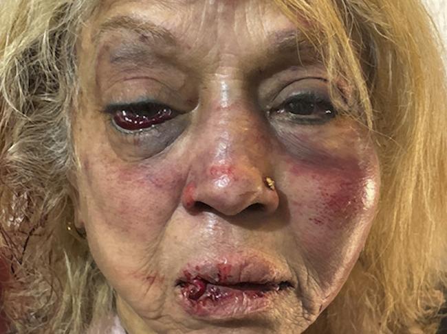 Ninette Simons, the victim of an assault and burglary in the Perth suburb of Girrawheen. Picture: WA Police