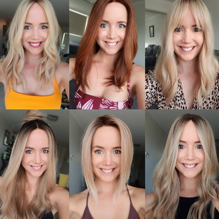 Alopecia Woman Shares Amazing Hair Loss Journey On Instagram News