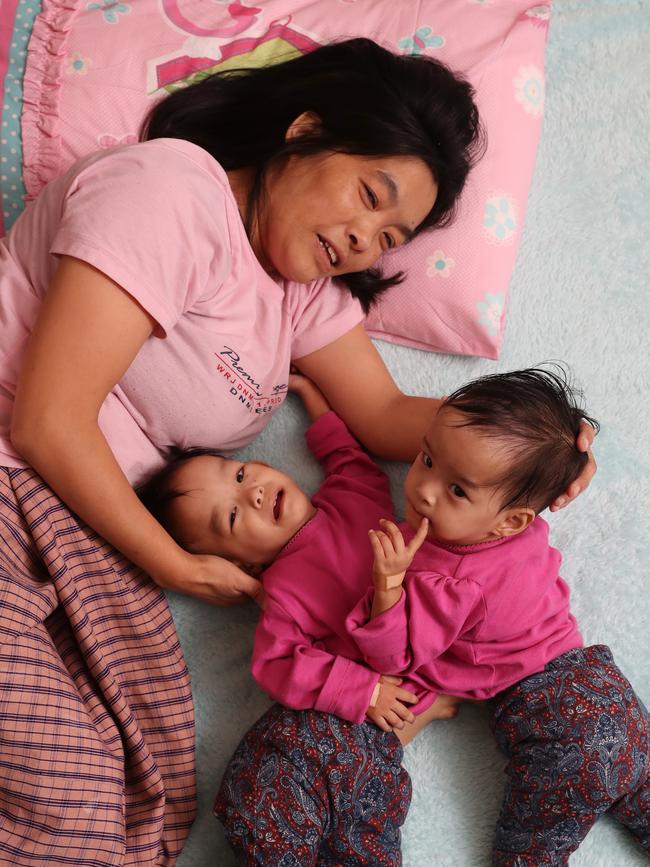 HERALD SUN ONLY-----4/10/2018. Bhutan Conjoined Twins.   Mum Bhumchu Zangmo lying with Nima [right], and Dawa [left] at the Children First Foundation, after a visit to the Royal Children's Hospital for scans and various tests under aesthetic.  Dawa has scratches on her face from her dominant sister. Picture: Alex Coppel.