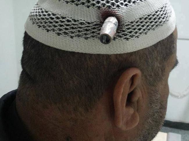 Sheikh Mohammed Obaid Al-Rawi waits for a doctor to remove a bullet lodged in his head.