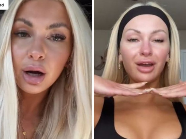 Woman told she looks double her age due to cosmetic treatments. Picture: TikTok