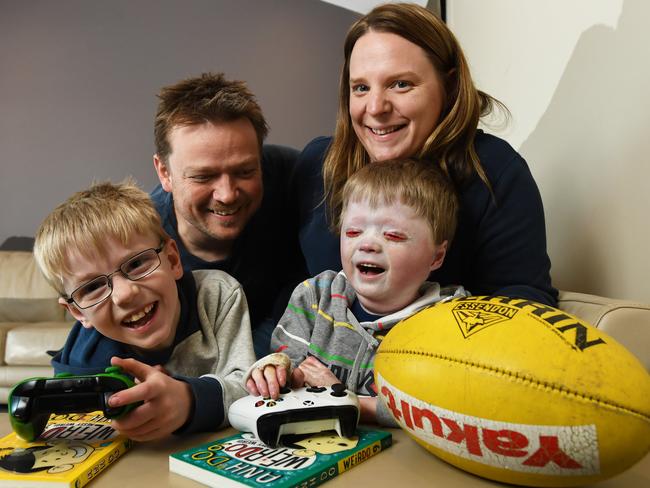 Miller, Jamie, Harrison and Leesa Pennicott have some fun before Harrison embarks on five months of treatment to try and cure him from scleroderma. Picture: JAMES ROSS.