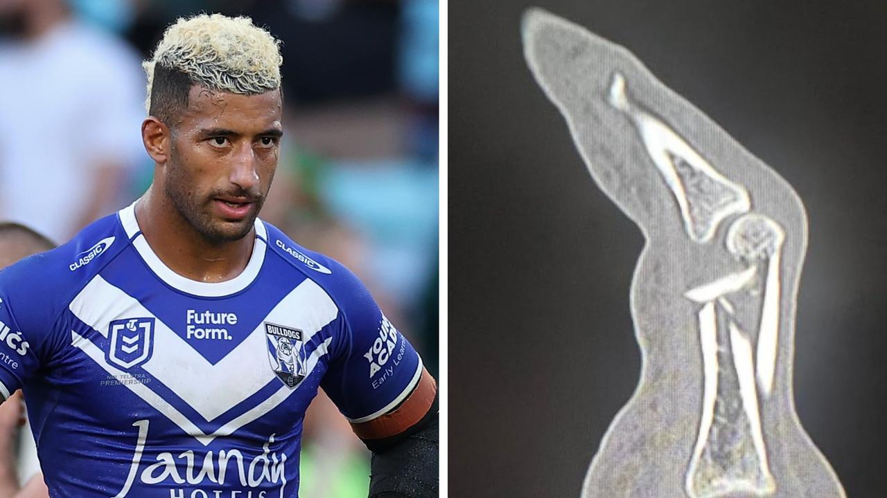 Viliame Kikau will miss up to six weeks with a finger injury.