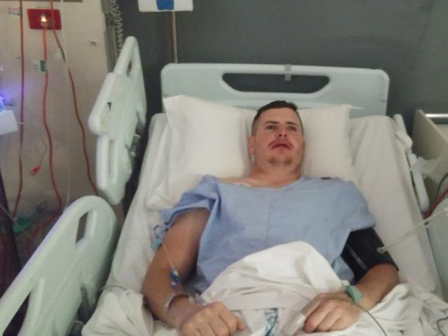 Ryan Holman, 23, of Murrurundi, suffered a severly shattered jaw after he was punched repeatedly on the ground by Iliesa Cama. Picture: Facebook