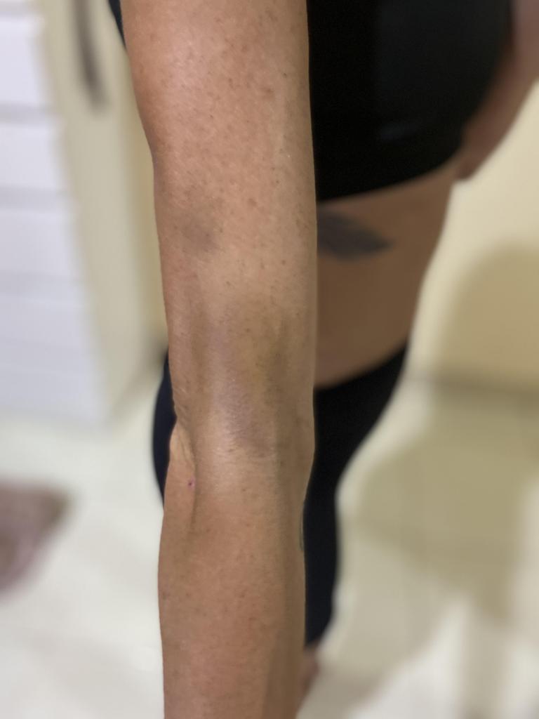 Melbourne DJ Courtney Mills reveals brutal Bali injuries NT News
