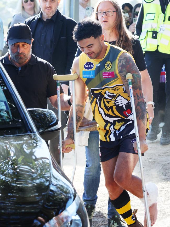 Guy Sebastian goes off injured. Picture: David Crosling