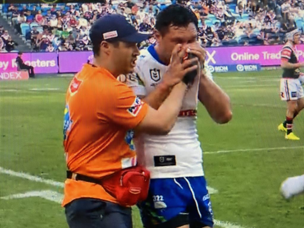 Jordan Rapana comes off with a fractured cheekbone.