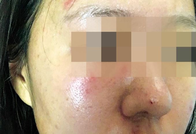 A woman has spoken out after a sickening attack in Bundaberg.