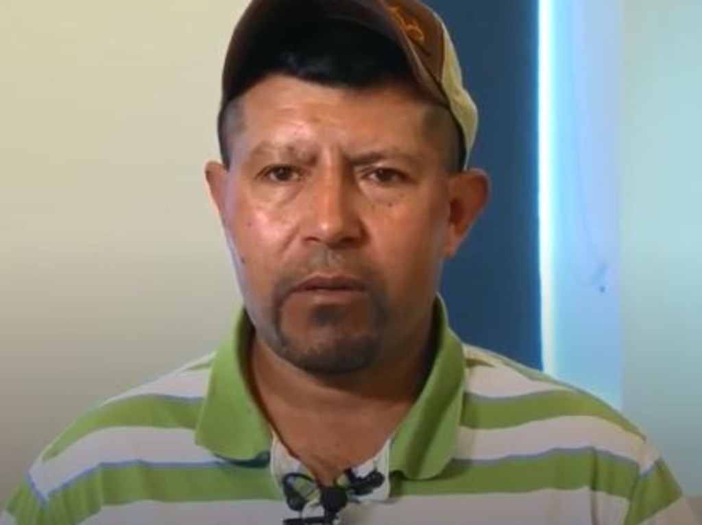 Gerardo Moctezuma discovered a tapeworm inside his brain. Picture: NBC News