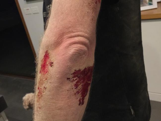 Jeff Brooks suffered grazes to his arm after a car drove at him during a violent home invasion in February.