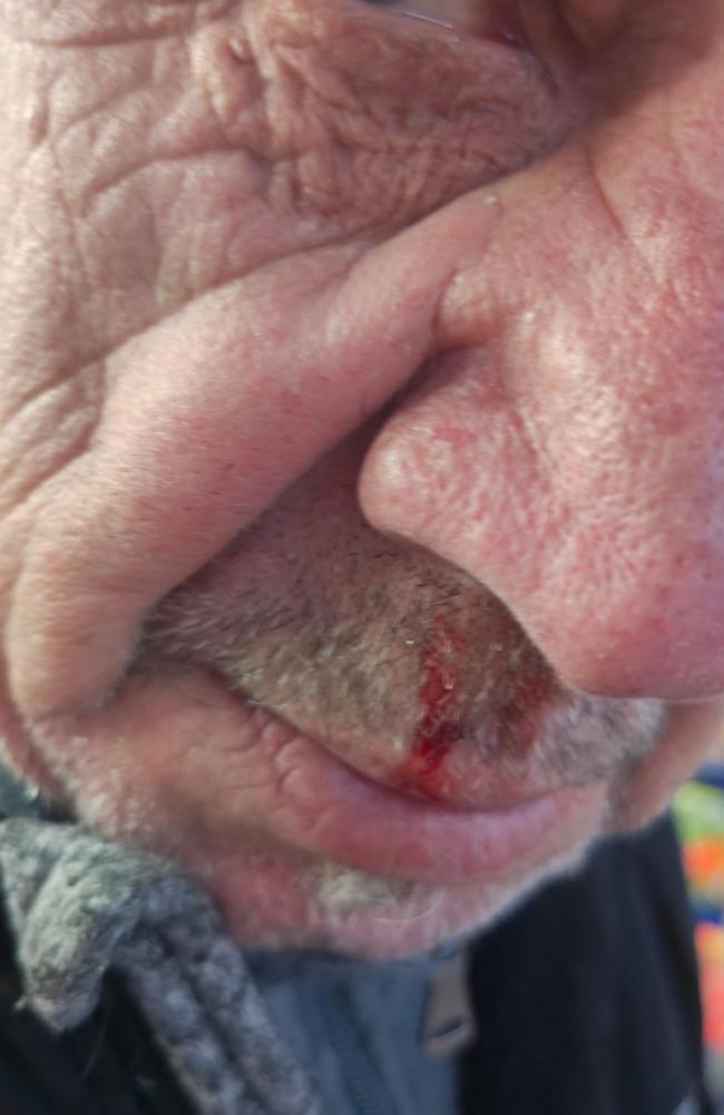 An elderly man bleeds from nose after getting assaulted at Nicholson St Mall. Picture: supplied.