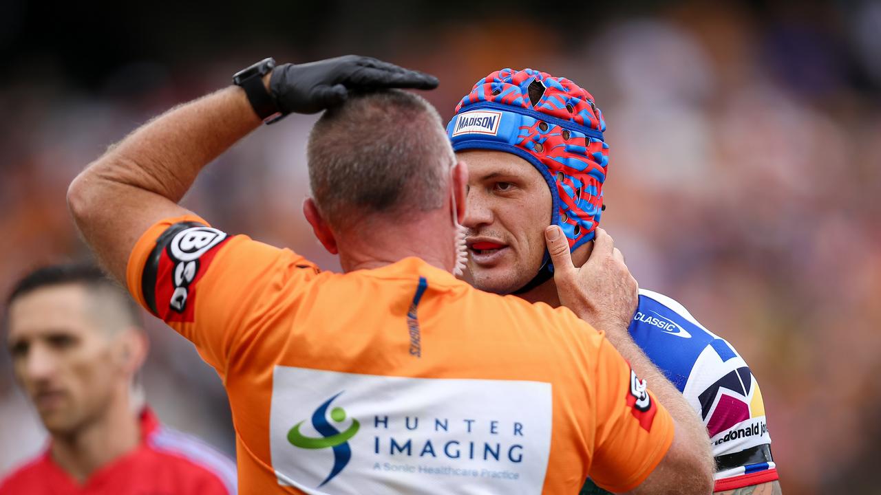 Kalyn Ponga has had his concussion issues. Picture: NRL Photos