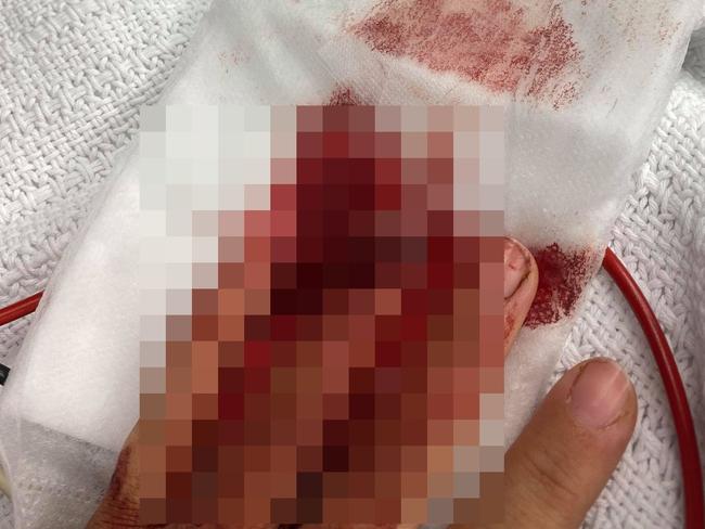 LEGELLED - PLEASE PIXELATE FACE AND DO NOT NAME IF PUBLISHING,  Zoe Tsitonakis, 21, was stabbed at random while jogging in Gowanbrae on September 3.