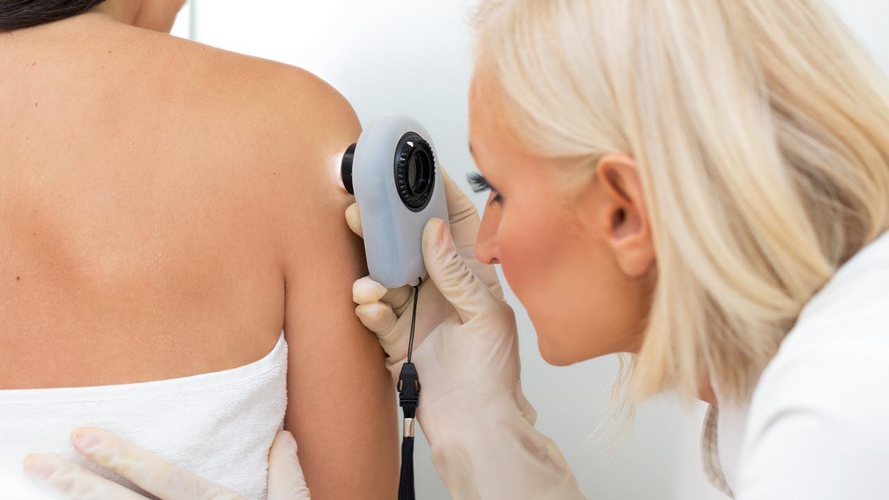 New skin cancer research hopes to make it easier to diagnose in regions