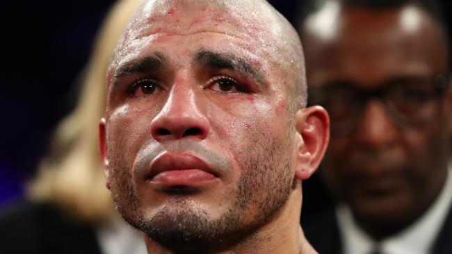 Miguel Cotto reacts after losing to Sadaam Ali.