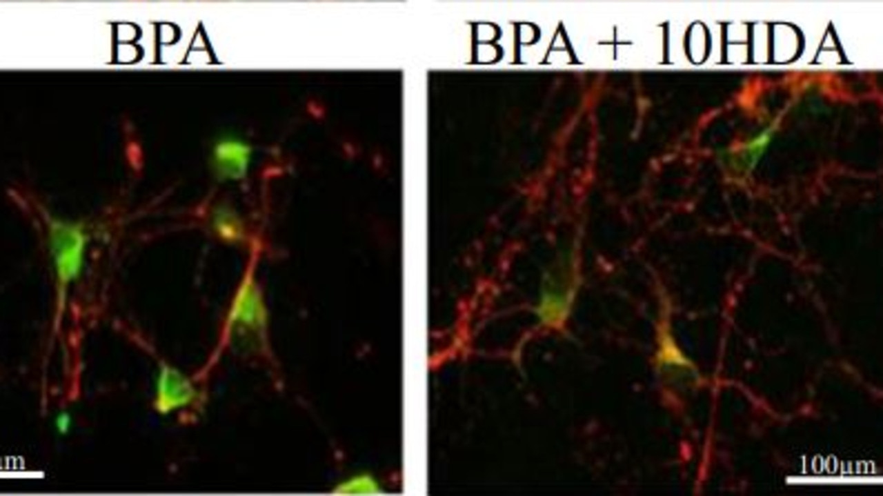 Professor Ponsonby said BPA can disrupt hormone controlled male fetal brain development Picture: Nature Communications