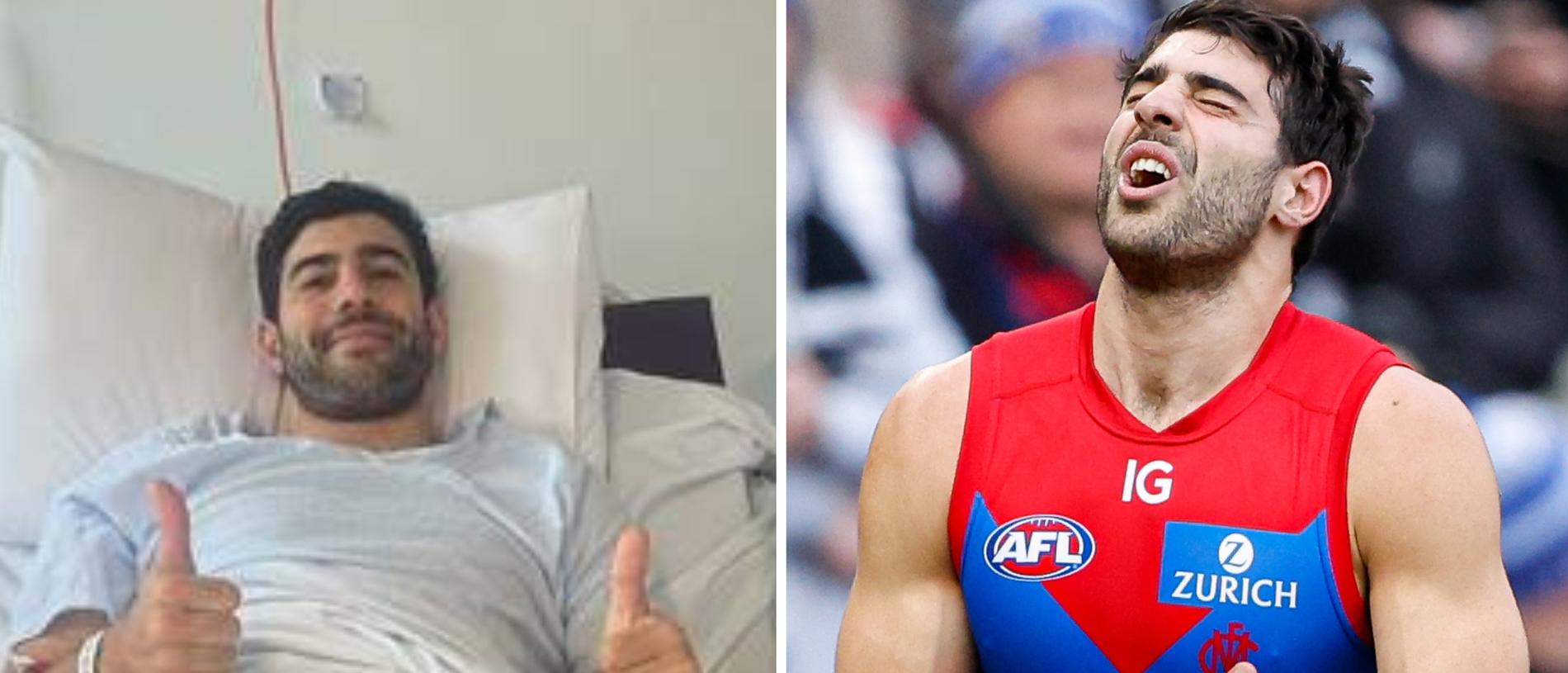 Demons superstar Christian Petracca has opened up on his “traumatic” recovery from a season-ending internal injury likened to a “car accident” victim including having gruesome open surgery.