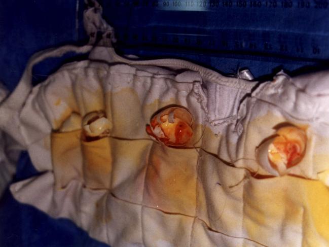 A customs photograph of bird eggs smuggled in a bra.