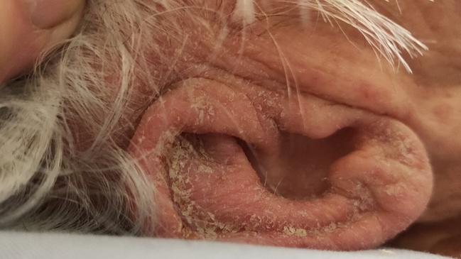 Kindred Living’s Annie Lockwood Court aged care facility is being investigated by federal authorities after allegations of poor conditions and a scabies outbreak. Picture: Supplied