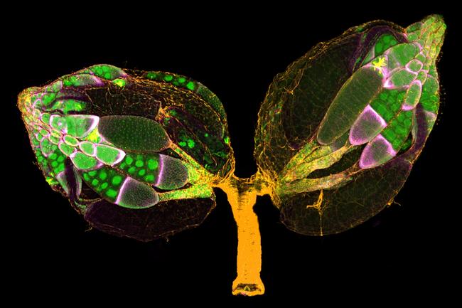 Nikon Small World 2019 11th Place - A pair of ovaries from an adult Drosophila Dr. Yujun Chen Dr. Jocelyn McDonald Kansas State University Department of Biology Manhattan, Kansas, USA