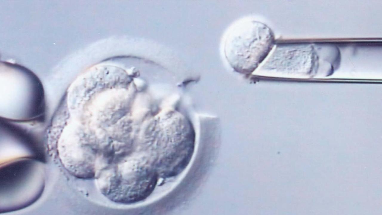 One IVF treatment cycle costs about $5550 after the Medicare rebate.