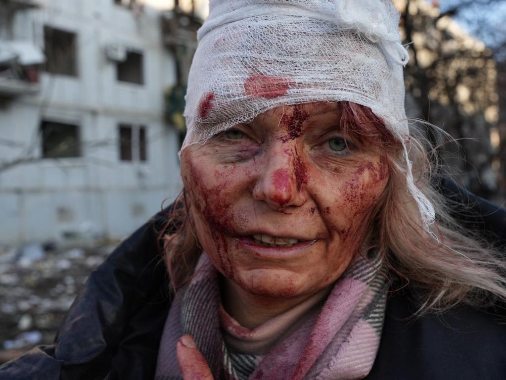 A wounded woman is seen as air strike damages an apartment complex outside of Kharkiv, Ukraine. Picture: Getty Images