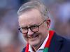 Voice circus lets Albo off the hook on punishing cost of living hikes