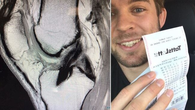 Melbourne Storm's Christian Welch celebrates his 'lucky' injury.