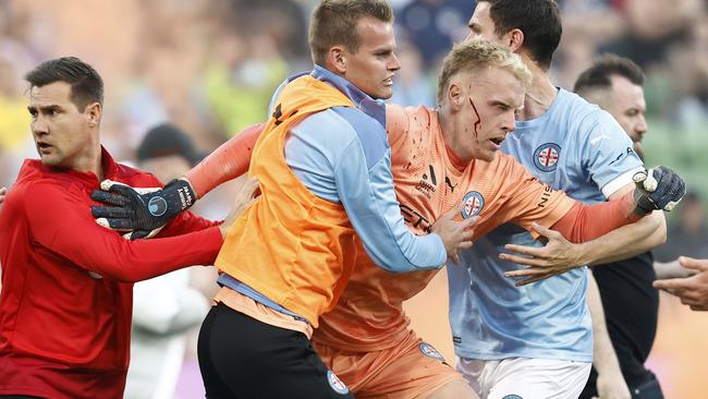 A bleeding Tom Glover is escorted from the pitch spectators stormed the pitch in last year’s match between Melbourne City and Melbourne Victory. Picture: Getty Images