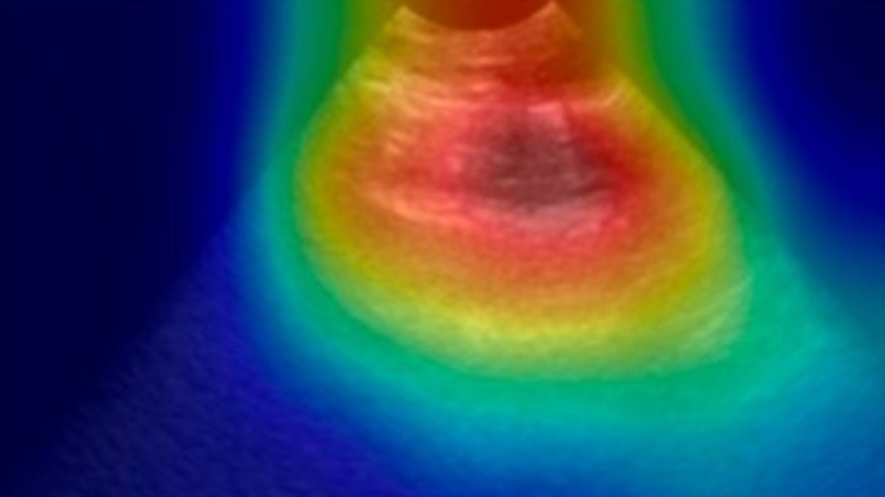 Lung heatmap examined by the AI model. Picture: Sourced from data by COVIDx-US