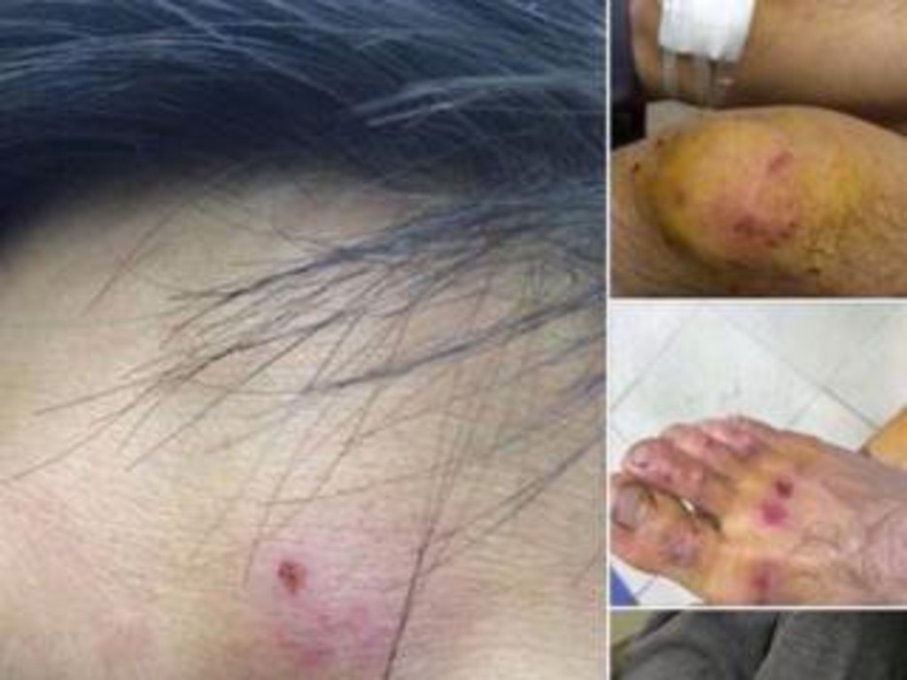 A collection of social media images purporting to show injuries sustained by Christian worshippers after a recent Communist Party raid.