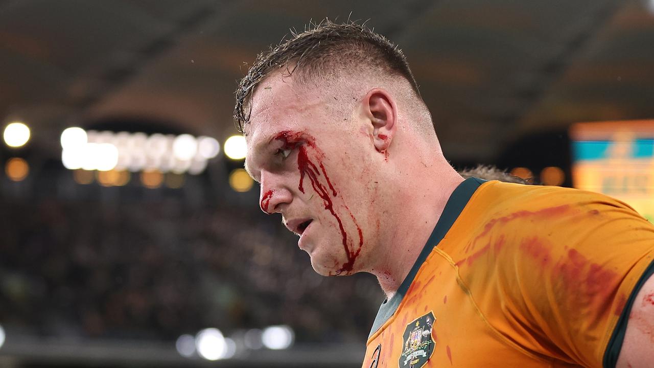 Wallabies hit back over fake injury claims