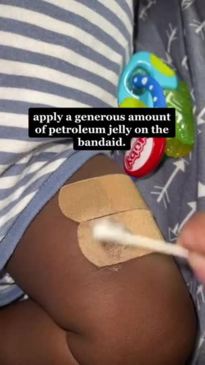 A mum of two has shared a hack to TikTok showing how she uses petroleum jelly to help BAND-AIDS slide off with no pain.