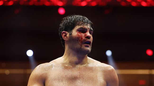 Filip Hrgovic looks on with a bloodied face. Photo by Richard Pelham/Getty Images)