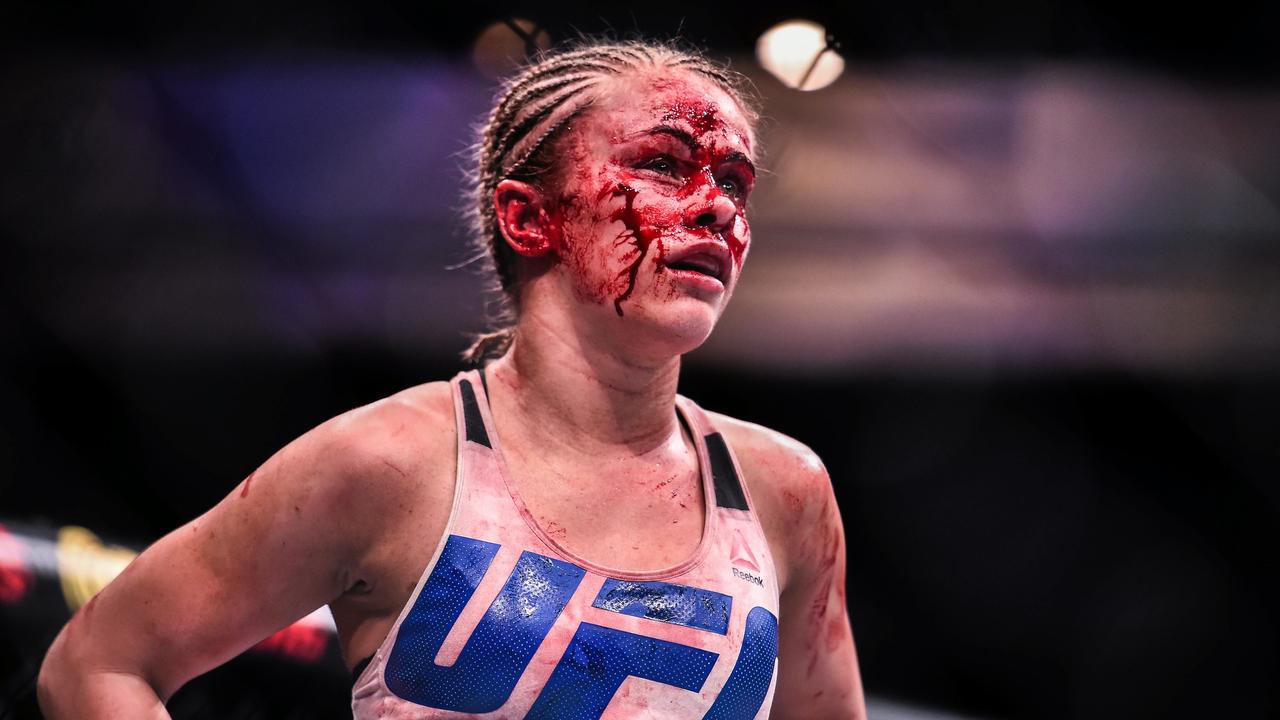 Paige VanZant took a few scrapes in her UFC career too. (Photo by Sportsfile/Corbis/Sportsfile via Getty Images)