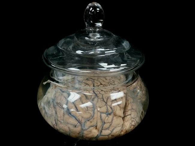 Ben Lovatt has previously sold human brains. Picture: Facebook