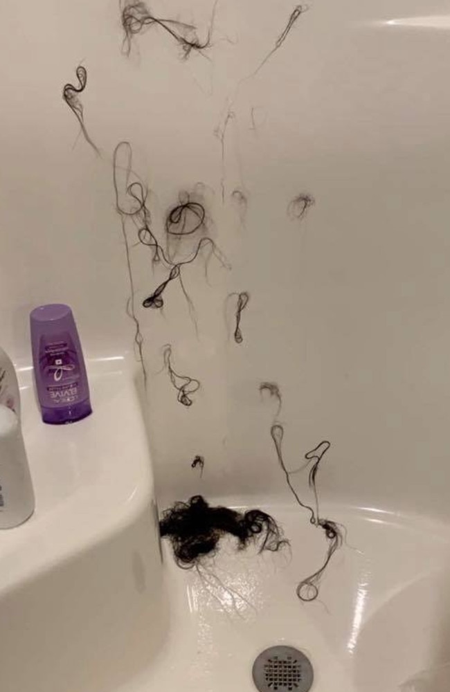 Ashley was horrified to see massive clumps of her hair falling out in the shower. Picture: Facebook