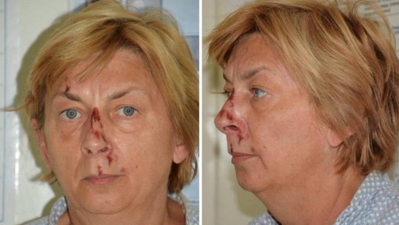 Photo of Záhada nemenovanej ženy v Chorvátsku je vyriešená