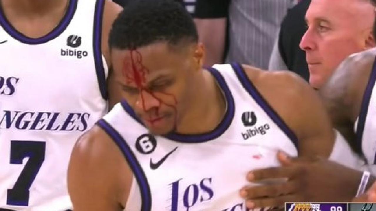 Russell Westbrook was left bloody.