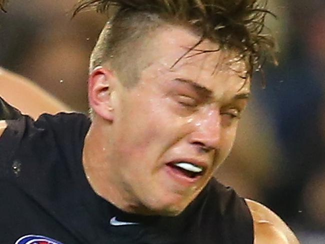 MELBOURNE, AUSTRALIA - MAY 01: Patrick Cripps of the Blues is tackled by Tyson Goldsack of the Magpies during the round five AFL match between the Carlton Blues and the Collingwood Magpies at Melbourne Cricket Ground on May 1, 2015 in Melbourne, Australia. (Photo by Quinn Rooney/Getty Images)