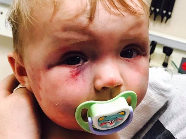 Evie was found to have suffered at least eight separate blows to the face and body.