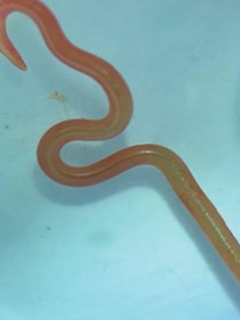 The 8cm worm was removed from the 64-year-old woman's brain during surgery. Picture: ANU