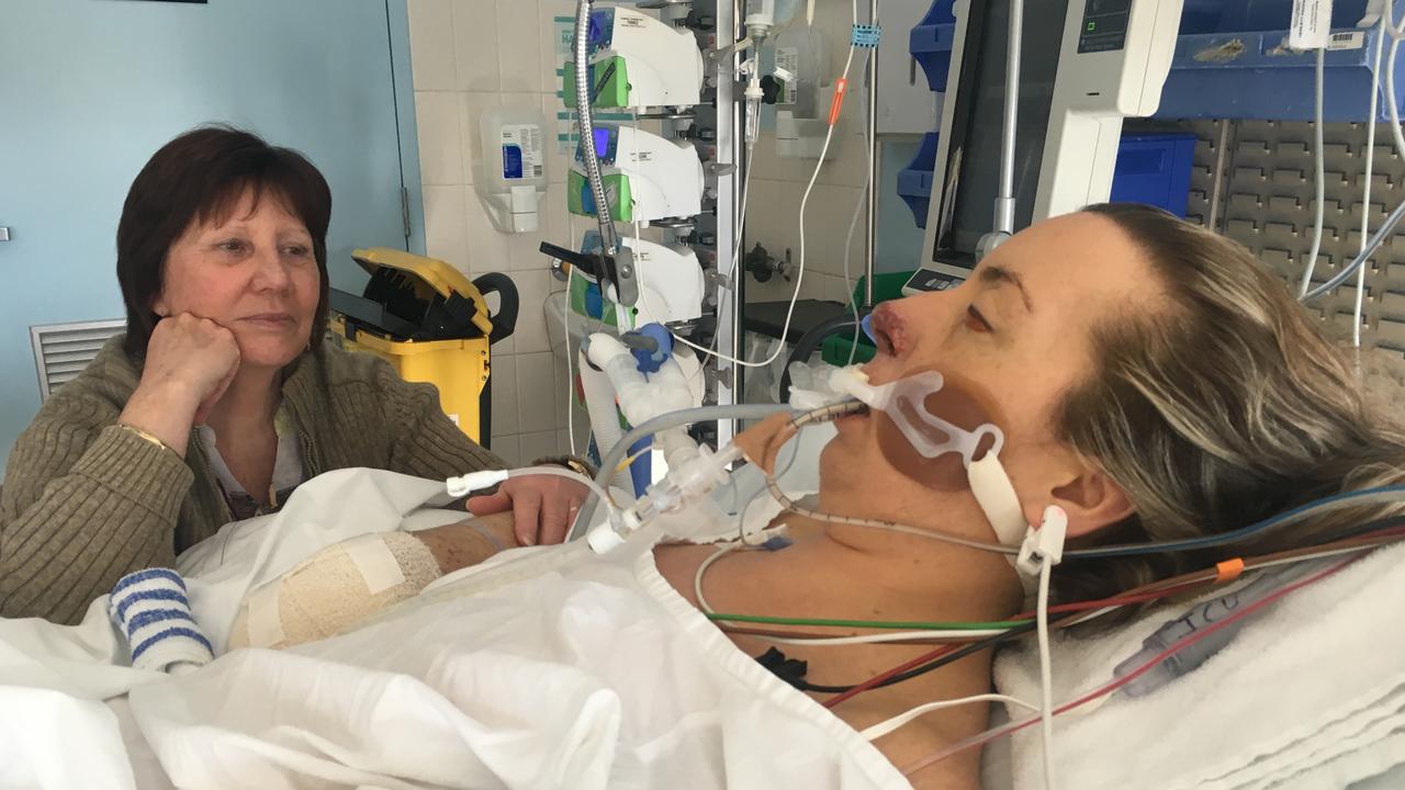 Sarah Joyce almost died of Meningococcal disease.