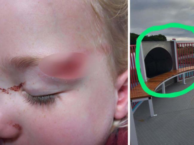 ‘Awful’: Mum’s warning to parents