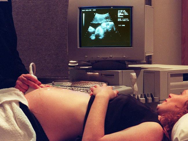 The ultrasound scanner was invented in Australia. Picture: Tony Lewis