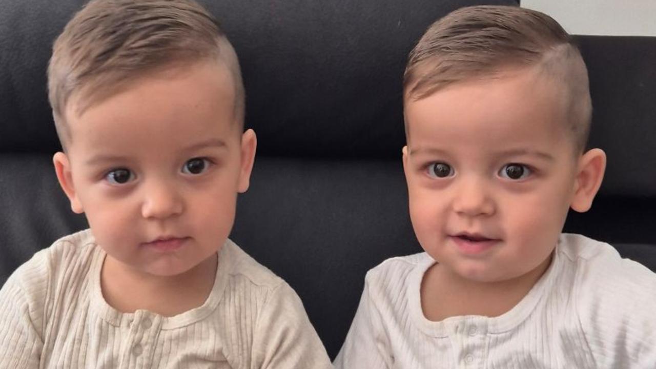 ‘Why me?’: Identical twin baby amputated after rare diagnosis