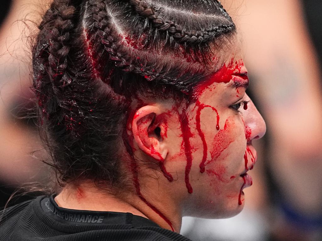 Mayra Bueno Silva looks on after being ruled out do to injury. Picture: Jeff Bottari/Zuffa LLC via Getty Images