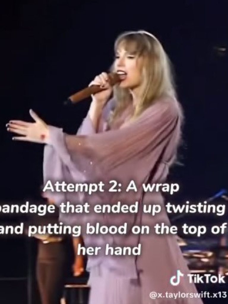 Taylor Swift’s wound is visible onstage. Picture: TikTok