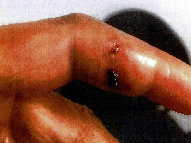 Grandma Mansis Bandi, 50, spared jail for biting off her friend's finger in a shocking act in October 2017. Supplied images